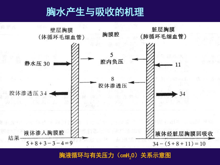 最新胸腔积液西交通大学第一医院PPT文档_第2页