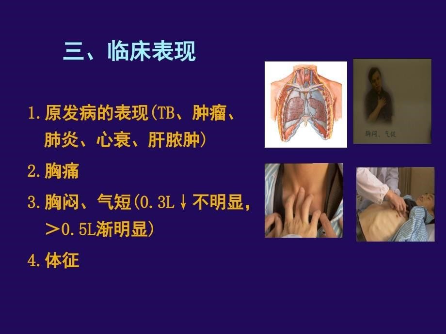 最新胸腔积液西交通大学第一医院PPT文档_第5页