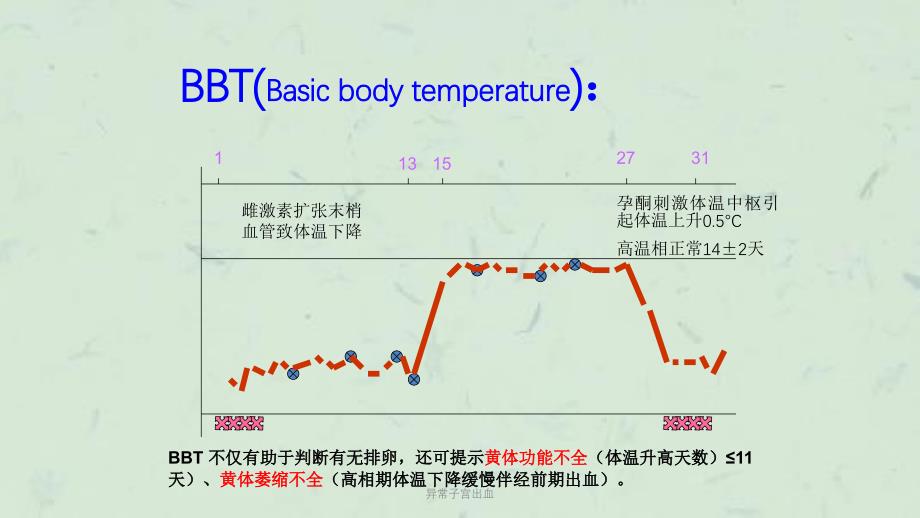 异常子宫出血课件_第4页