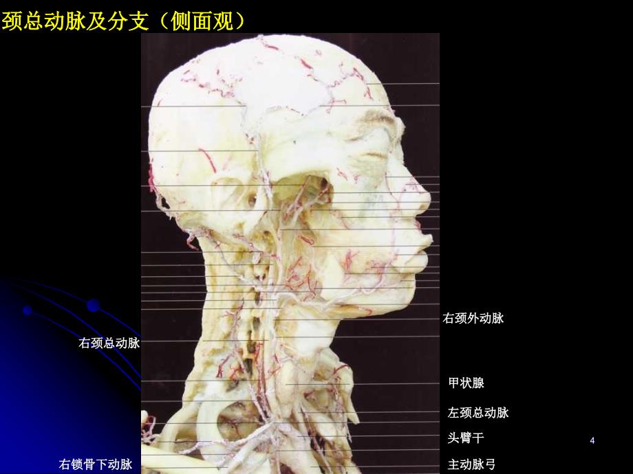 优质医学神经血管解剖图_第4页