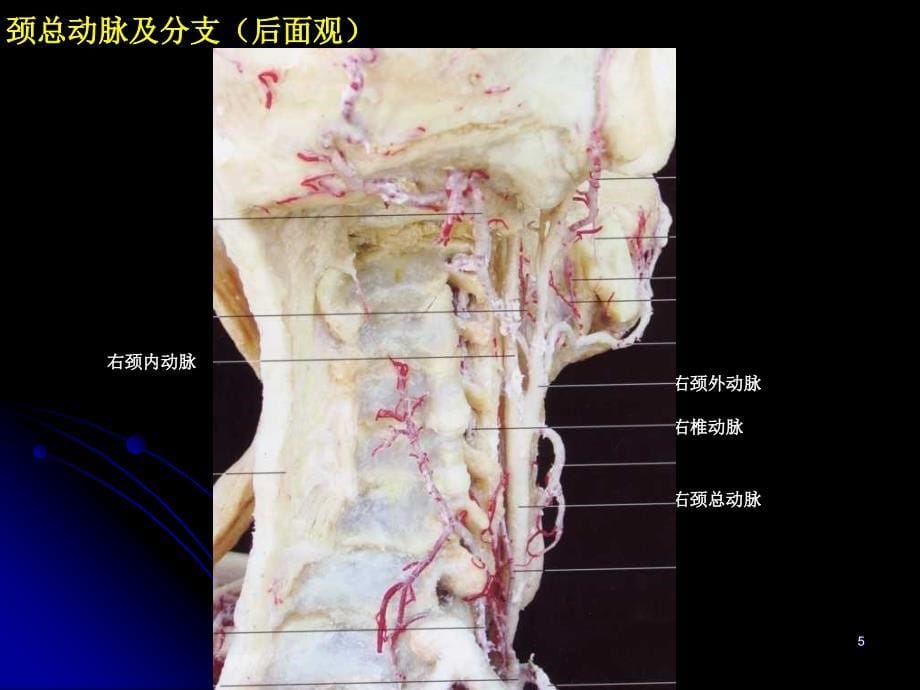 优质医学神经血管解剖图_第5页