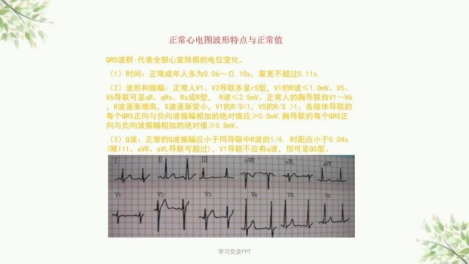 各种心电图表现课件_第5页