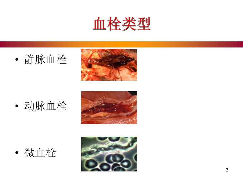 凝血紊乱与临床实践ppt参考课件_第3页