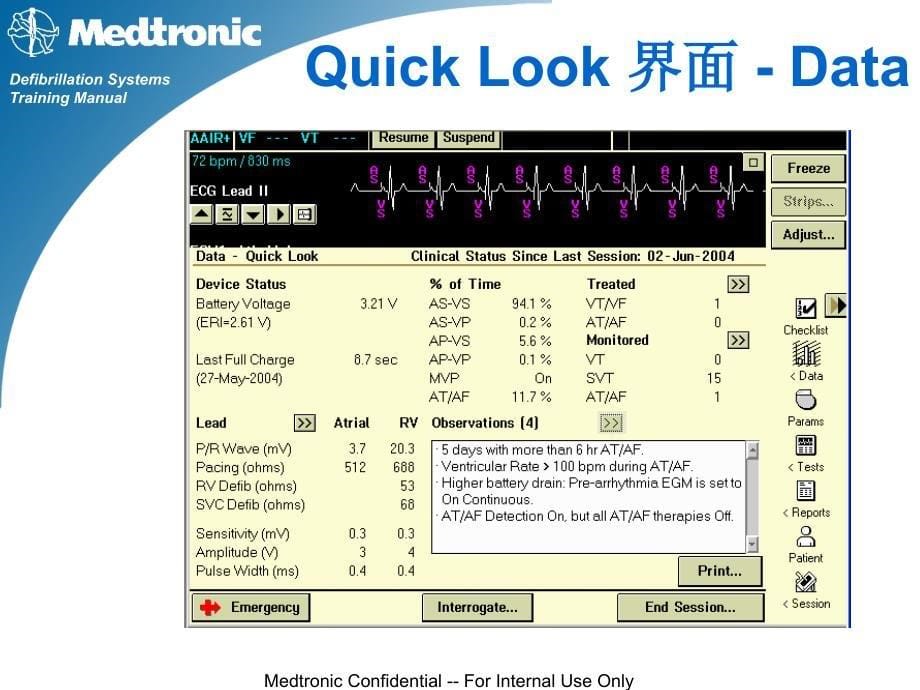 心脏起搏器培训资料：A7-ICD 随访技术_第5页