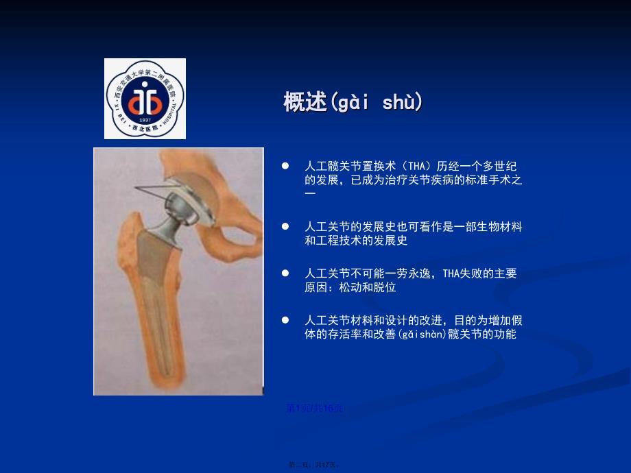 人工髋关节假体材料马瑞学习教案_第2页