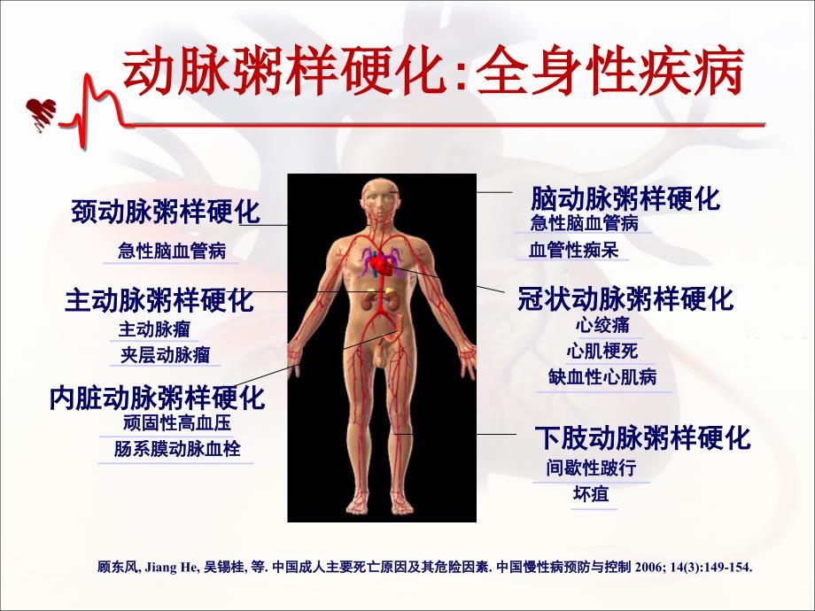 吴宗贵动脉粥样硬化c长沙_第4页