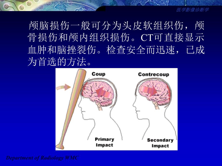 医学影像诊断学课件_第2页