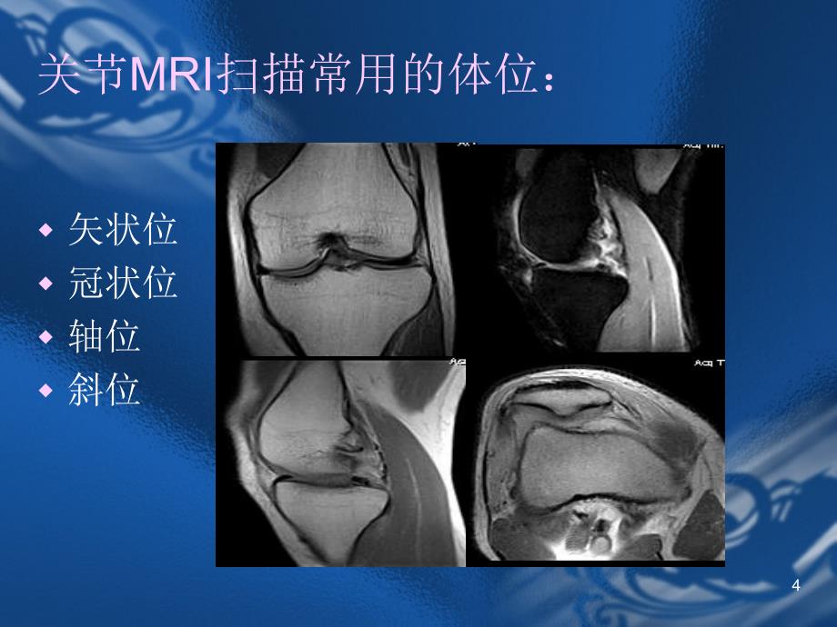 MRI骨关节诊断_第4页