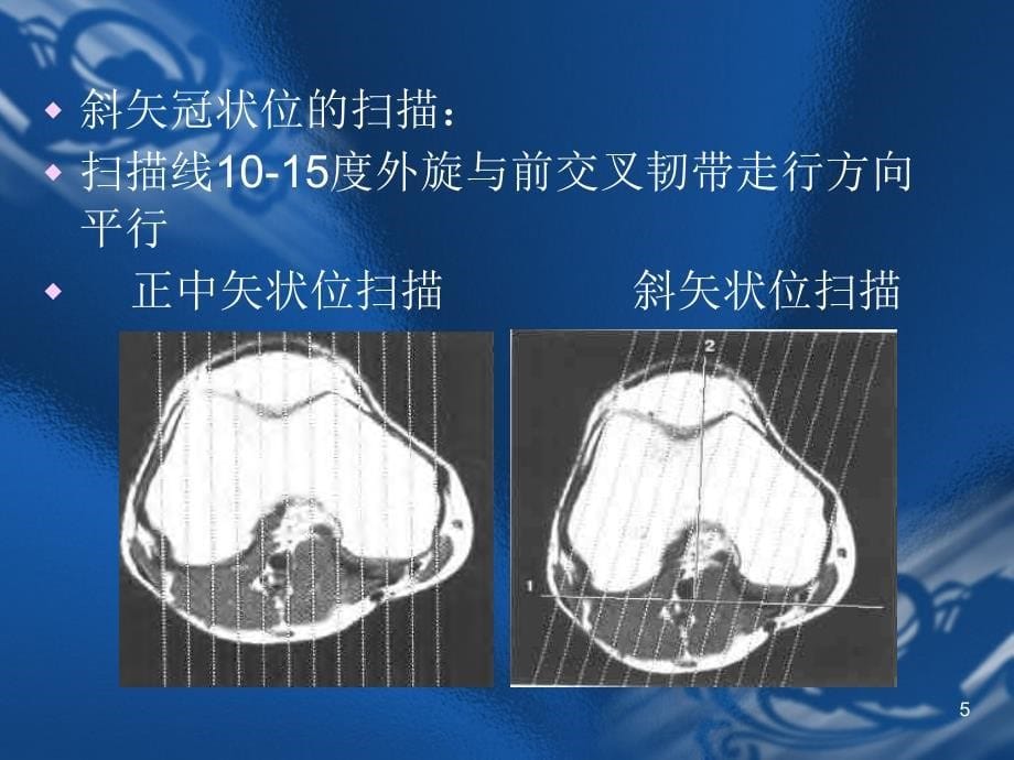 MRI骨关节诊断_第5页