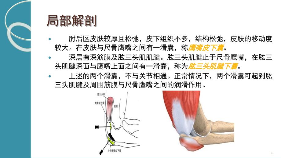 尺骨鹰嘴滑膜囊炎课堂PPT_第4页