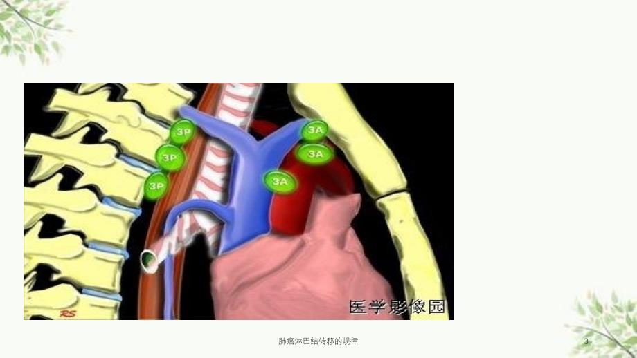 肺癌淋巴结转移的规律课件_第3页