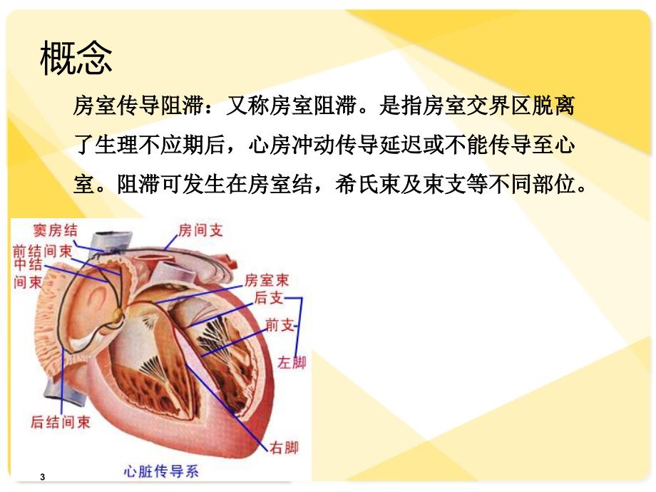 三度房室传导阻滞护理查房课件_第3页