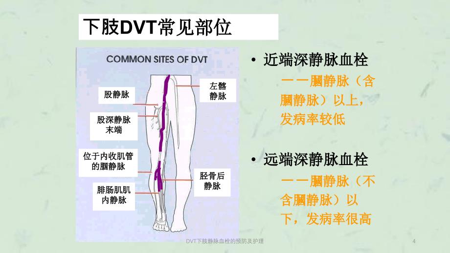 DVT下肢静脉血栓的预防及护理课件_第4页