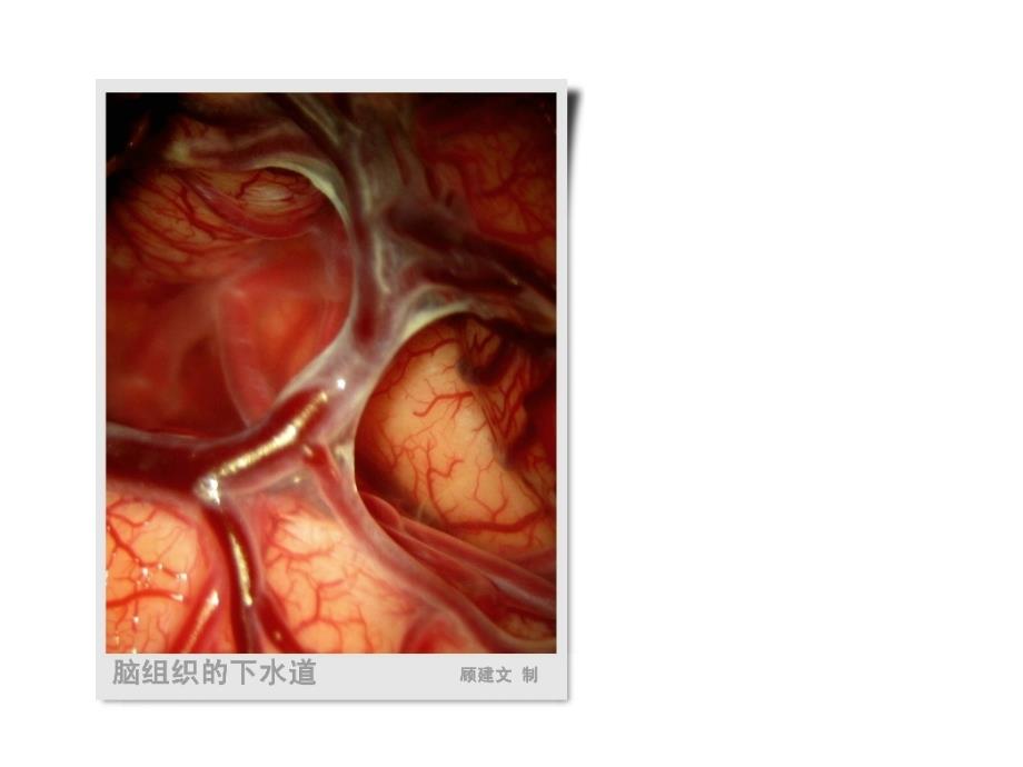 详解脑静脉系统解剖与血栓形成ppt课件_第4页