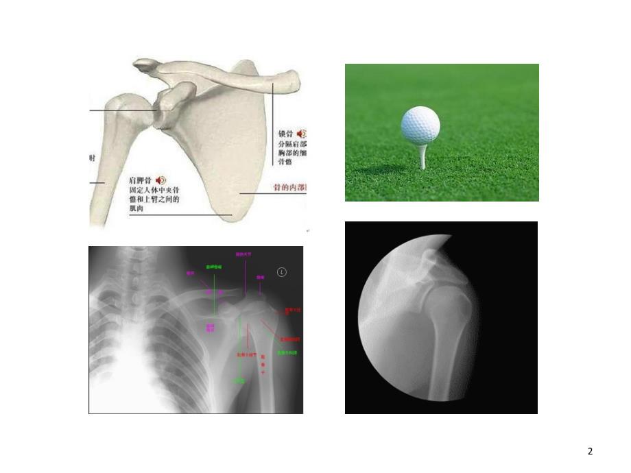 外科学关节脱位课堂PPT_第2页