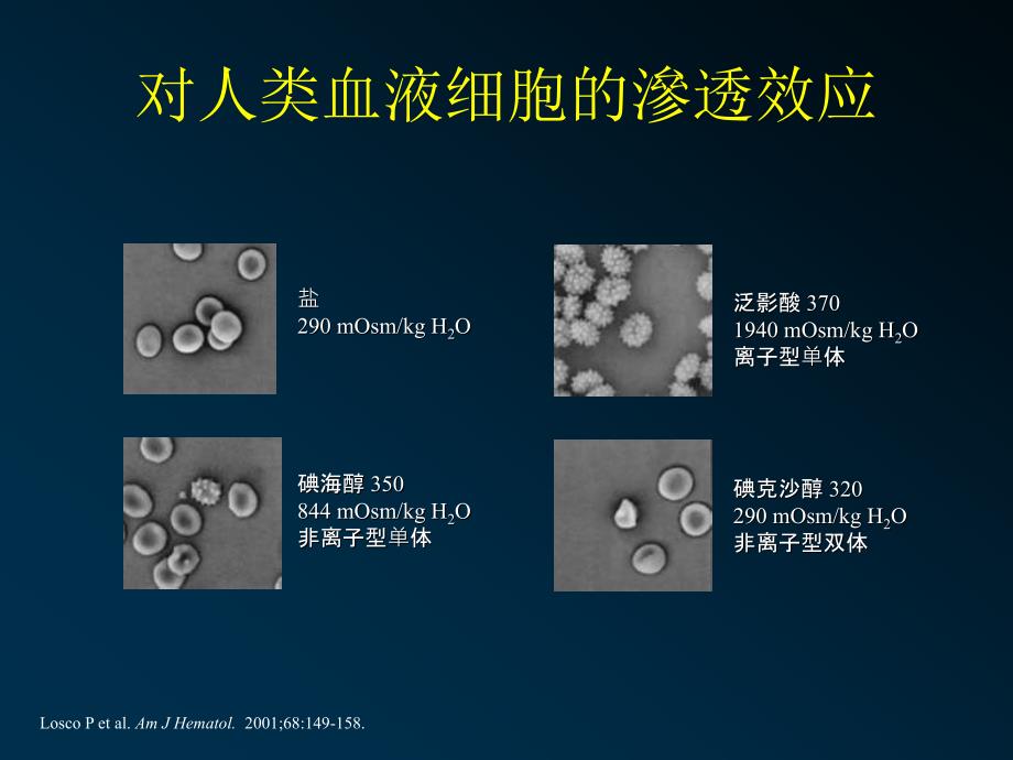 对比剂肾病研究进展_第4页