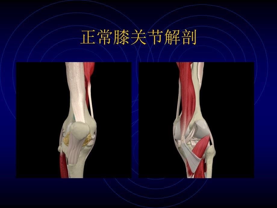 膝关节损伤常用检查法.ppt_第5页