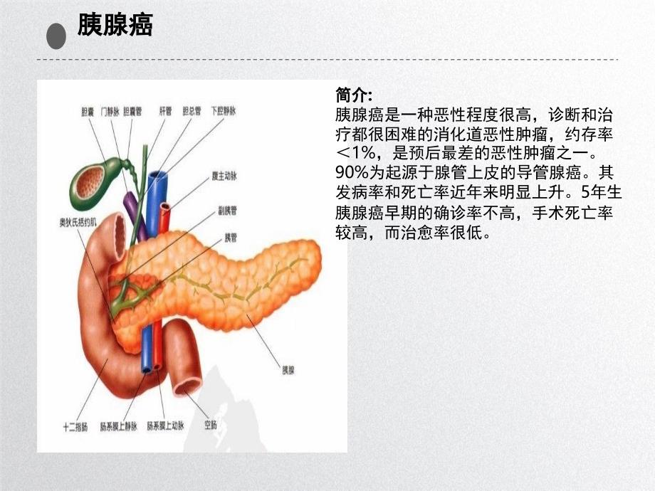 胰腺癌护理查房_第4页