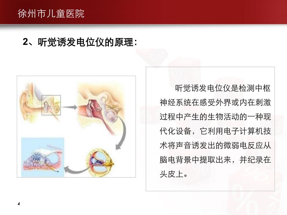 脑干诱发电位—刘军课件_第4页