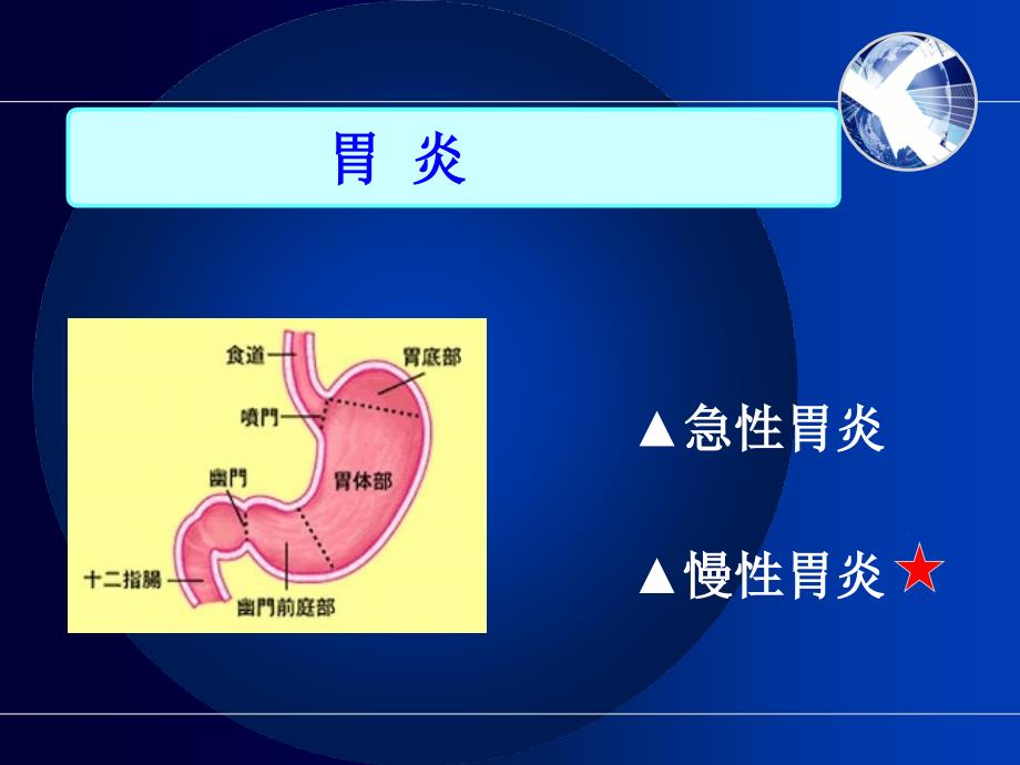 慢性胃炎护理查房.ppt_第2页