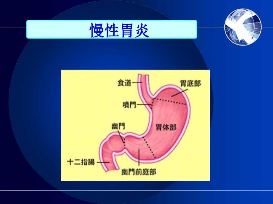 慢性胃炎护理查房.ppt_第4页