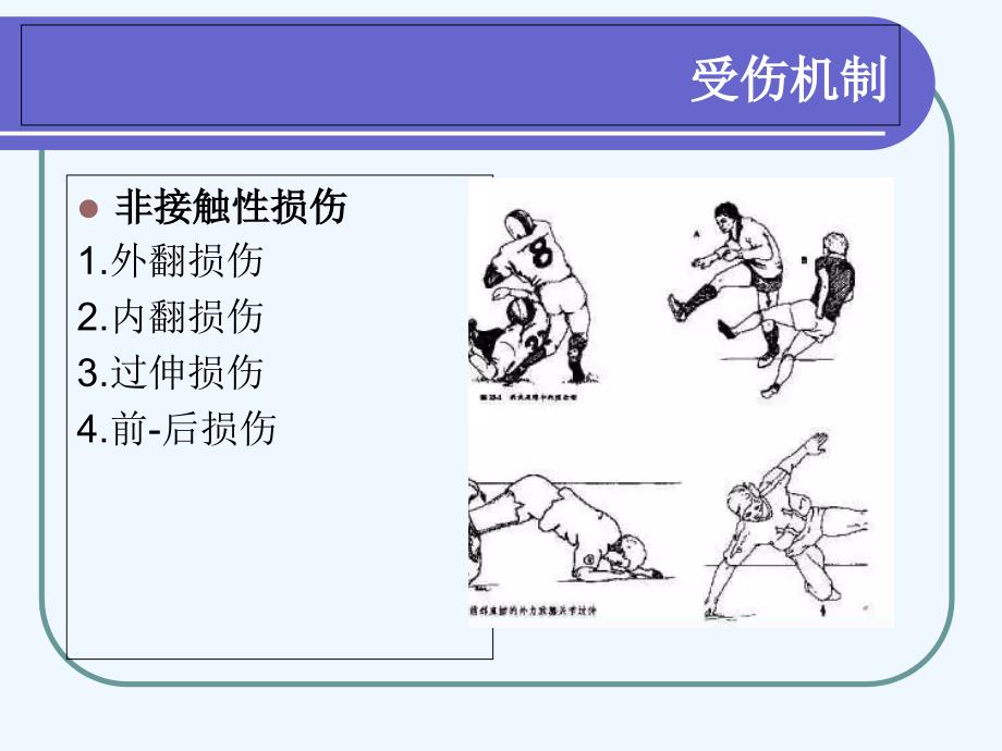 关节镜下前交叉韧带重建手术配合_第4页