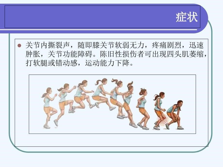 关节镜下前交叉韧带重建手术配合_第5页