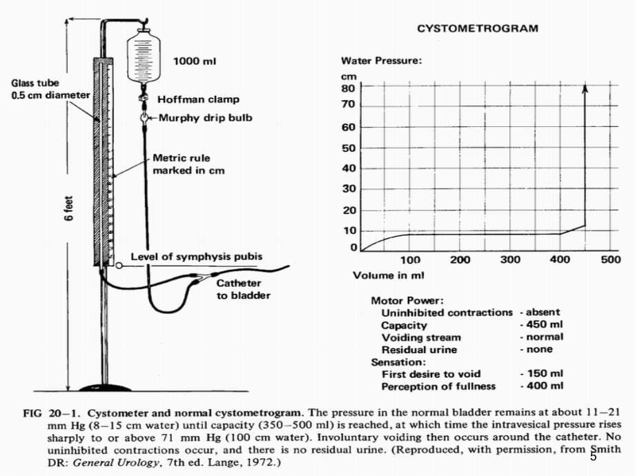 水柱法膀胱内压力与容量测定_第5页