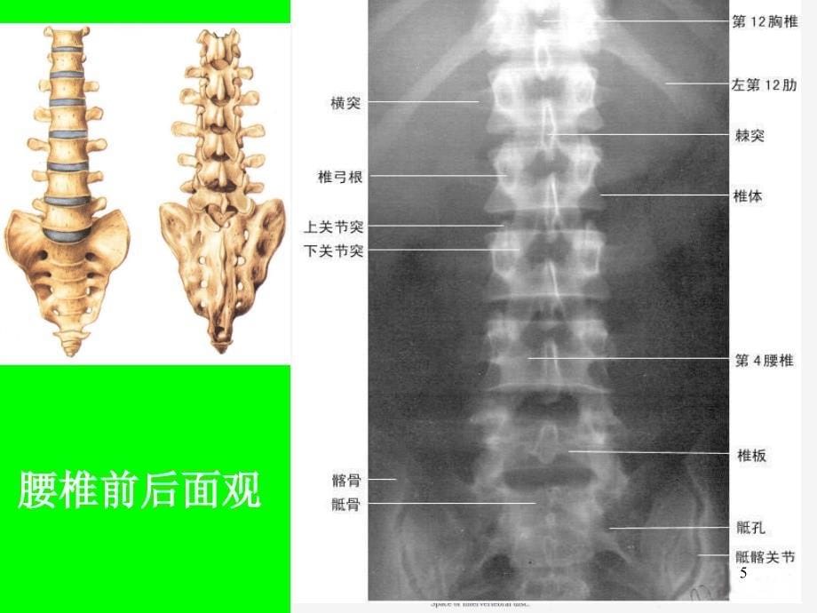 腰椎解剖应用PowerPoint 演示文稿_第5页