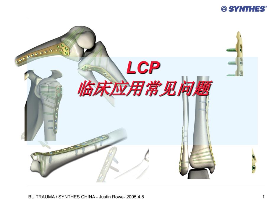 锁定内固定系统临床应用常见问题LCPQuestions_第1页