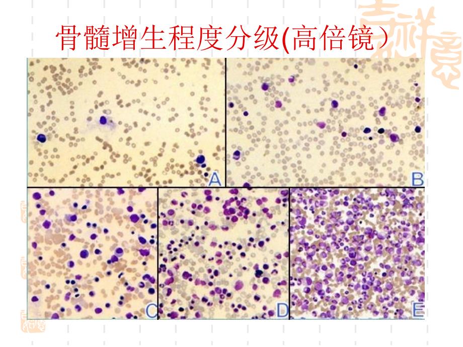 骨髓象检查的步骤与方法_第3页