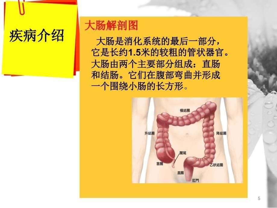 直肠癌护理查房ppt课件.ppt_第5页