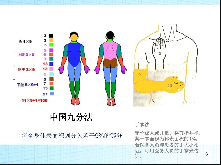 烧伤和冻伤ppt课件_第3页