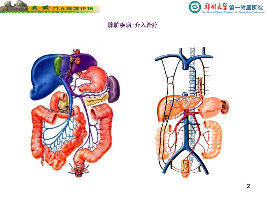 脾脏的介入栓塞治疗ppt课件_第2页