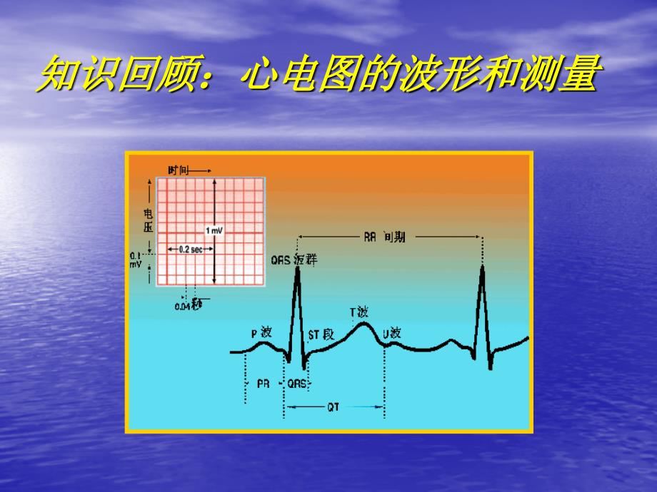 常见心脏疾病心电图诊断.ppt_第4页