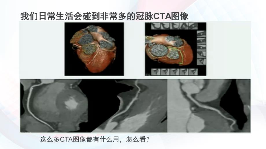 冠脉CTA读片基础教程_第4页