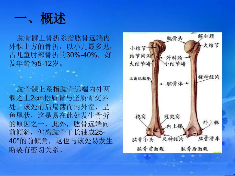 肱骨髁上骨折.ppt_第2页