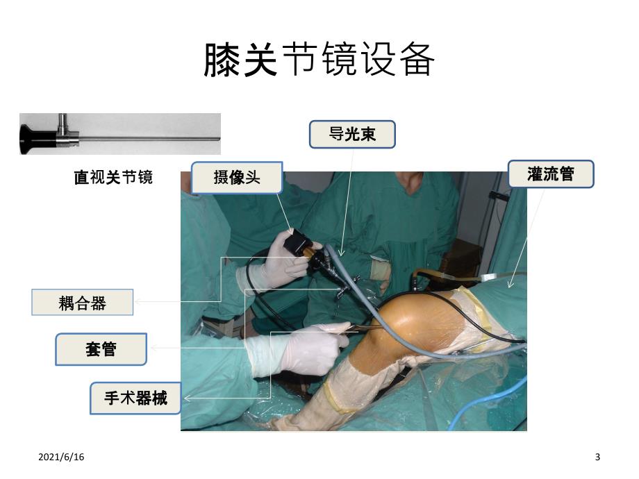 膝关节镜手术的准备、体位和317_第3页