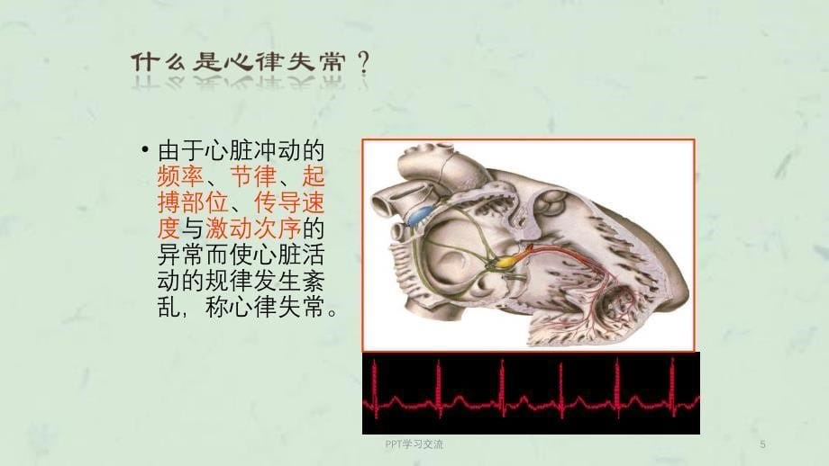 恶性心律失常的识别与护理ppt课件_第5页