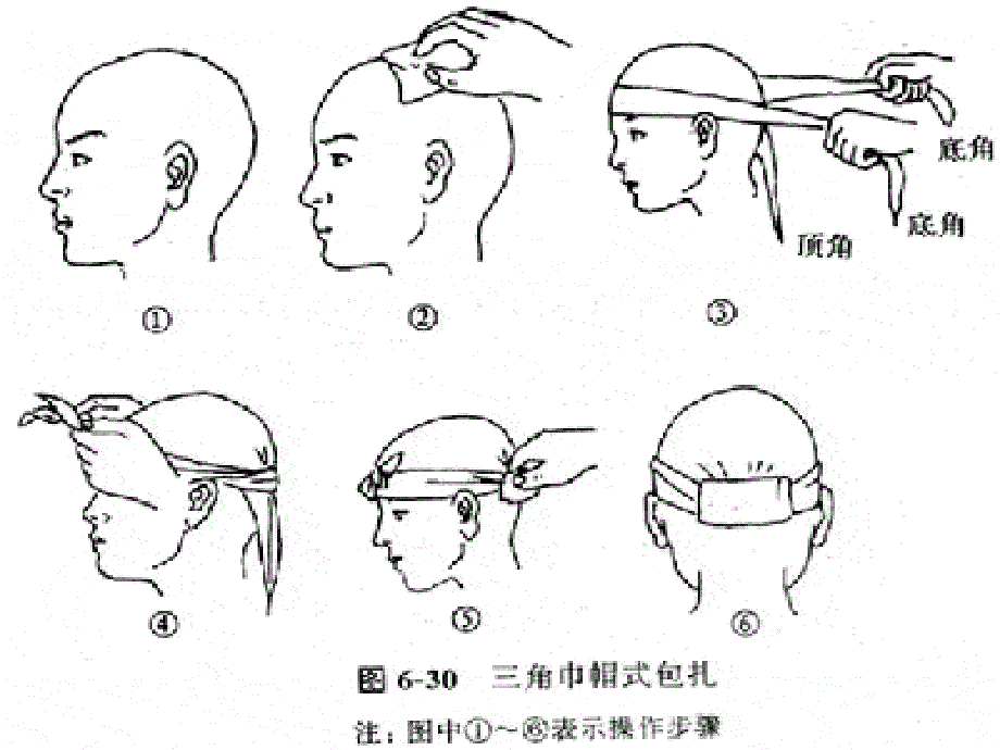 包扎与固定ppt课件_第4页