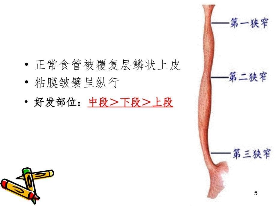 消化系统疾病肿瘤.ppt_第5页