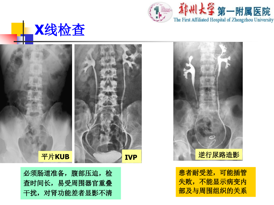 医学影像学：泌尿系统_第4页