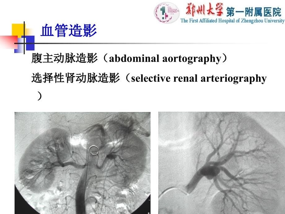 医学影像学：泌尿系统_第5页