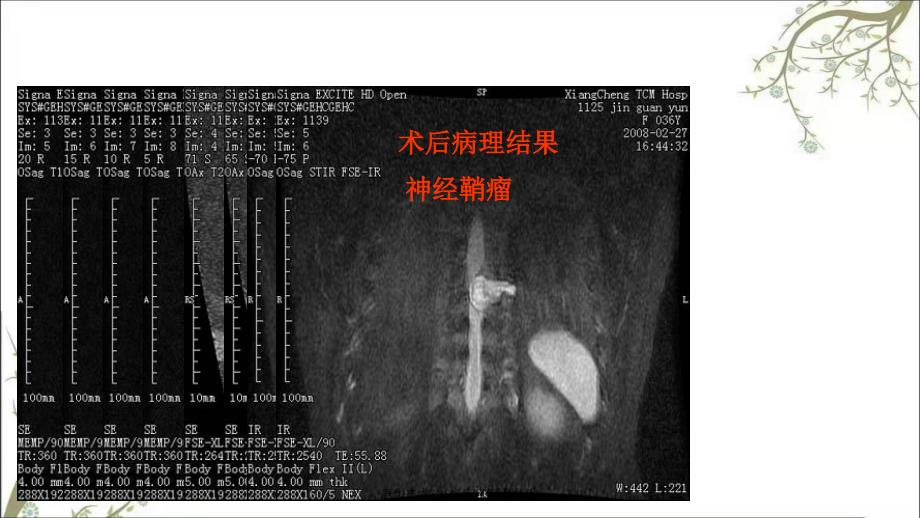 医影在线CNS疾病MRI诊断优秀_第3页