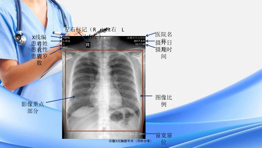 读懂X线胸部平片课件分享_第4页