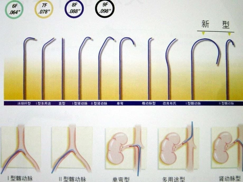 《医学影像学》课件：第四章：介入放射学_第5页