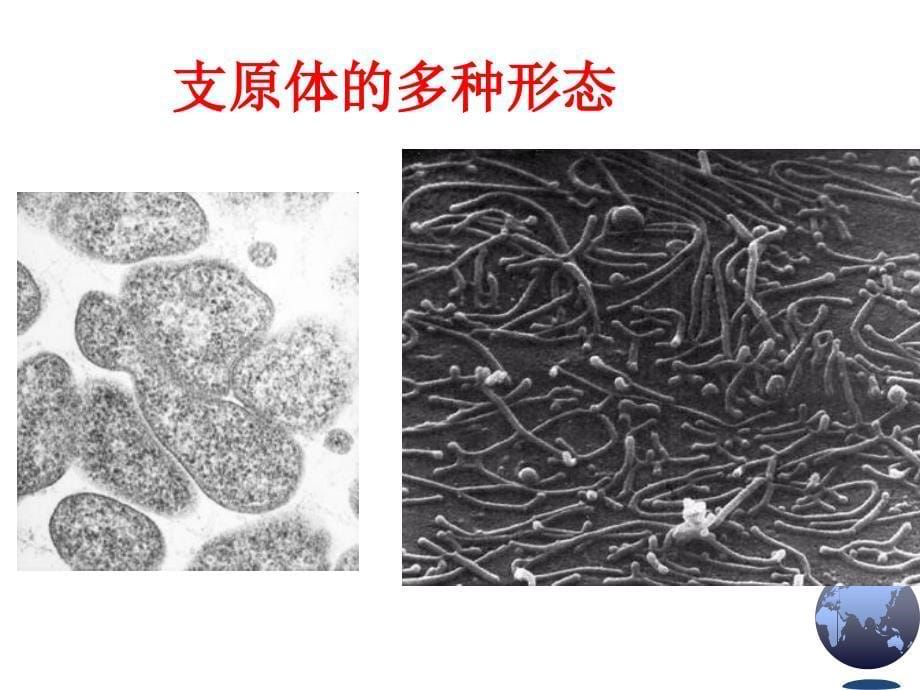 支原体、立克次体、衣原体、螺旋体.ppt_第5页