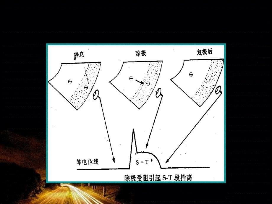 急性心肌梗死指南解读文档资料_第5页