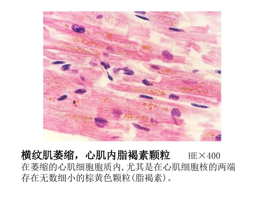 《病理切片复习》PPT课件_第2页