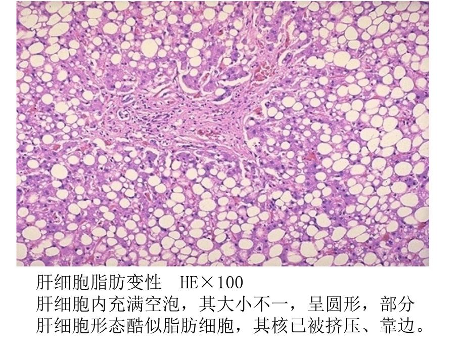 《病理切片复习》PPT课件_第4页